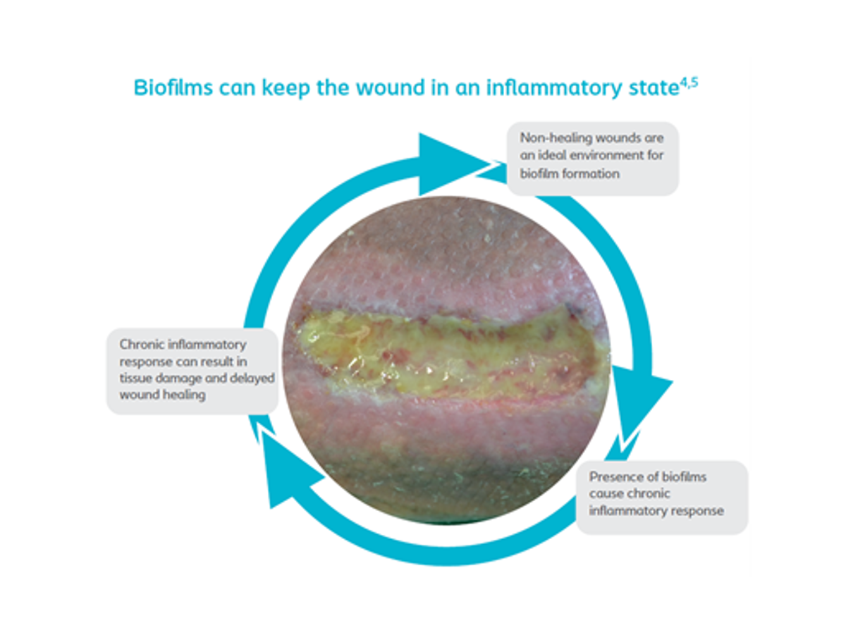 How do biofilm affect wound healing?