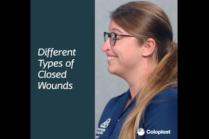 <h2>Treat, different types of closed wounds</h2>