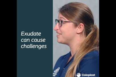 <h2>Exudate can cause challenges</h2>
