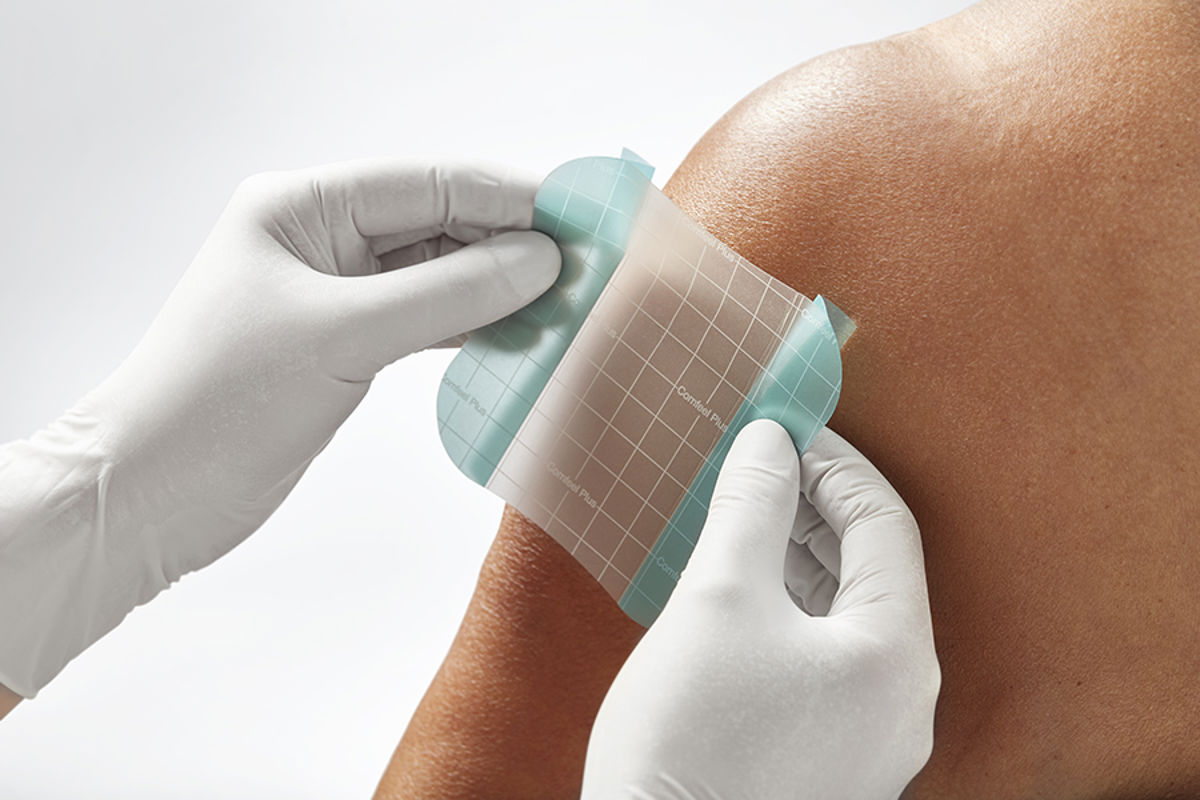 How do I select the right hydrocolloid dressing?